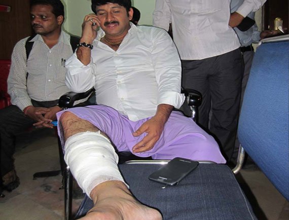Bhojpuri Megastar Manoj Tiwari Injured