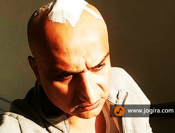 awadhesh mishra injured during film shoot